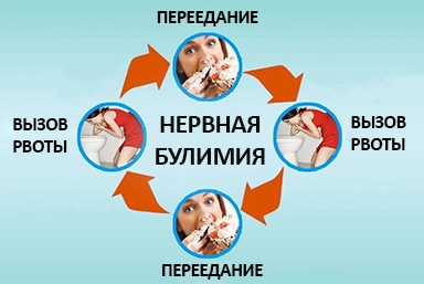 Лечение булимии в Красноармейске
